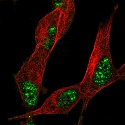 ZNF179 Antibody, Novus Biologicals 0.1mL; Unlabeled:Antibodies, Polyclonal